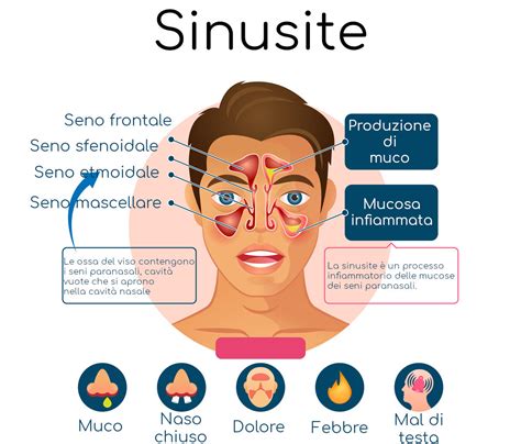 Scolo Nasale Sanguinante E Sintomi Della Sinusite